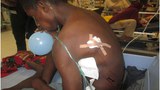 150910_ID_PAPUA_SHOOTINGS_620.jpg
